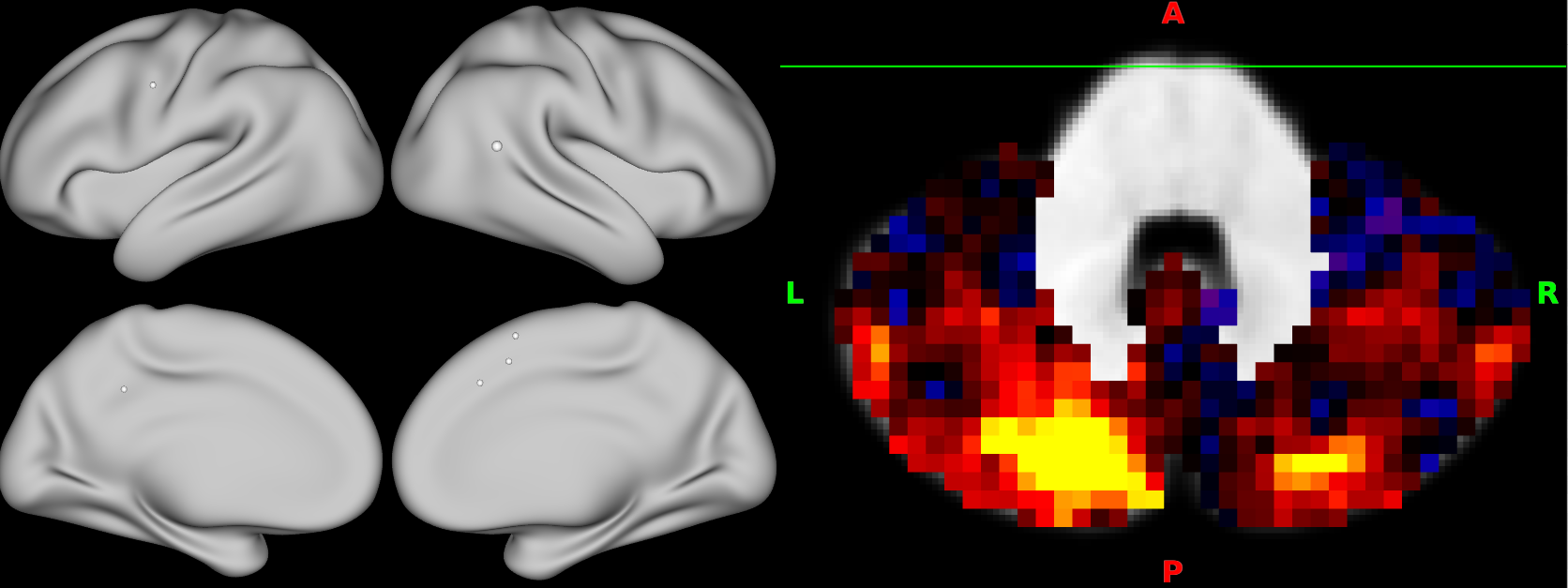 dpconn example